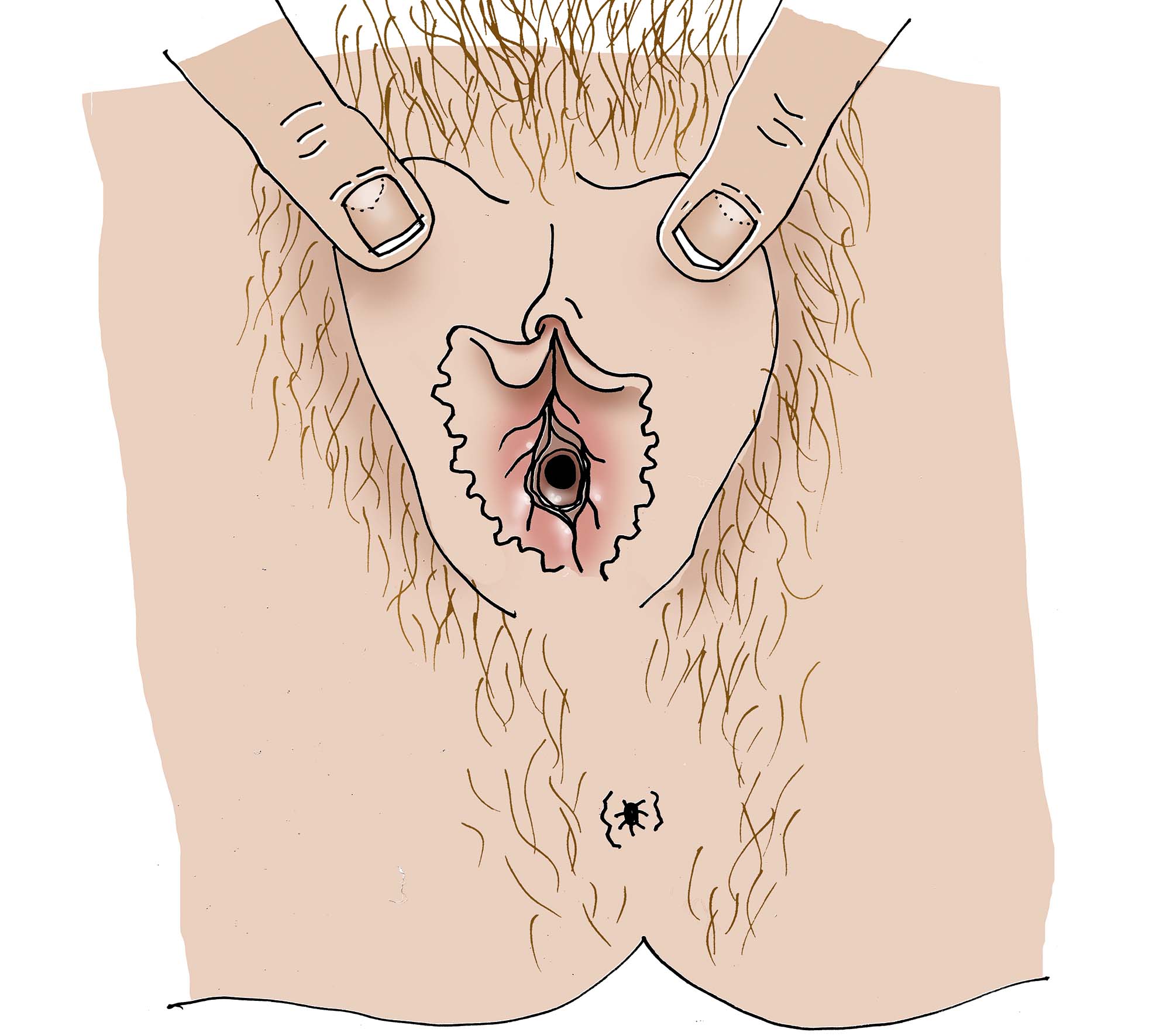 En färglagd anatomisk illustration av en vulva där två fingrar särar på blygdläpparna uppifrån. Bilden ger en tydlig vy av slidkransens flikiga slemhinnekant och dess placering i förhållande till urinröret och klitoris.
