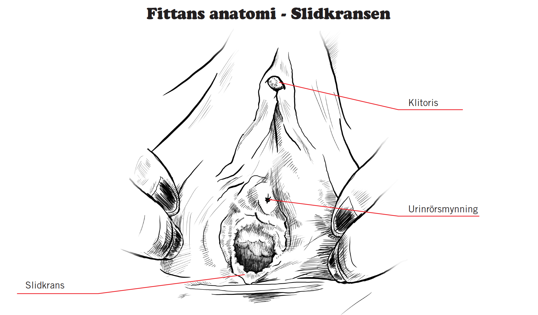 kirurgi slidan