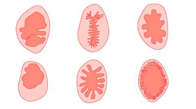 Oskuld blöda Oskuld blöda